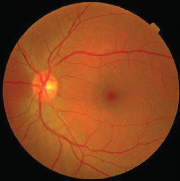 Retinal Scanning