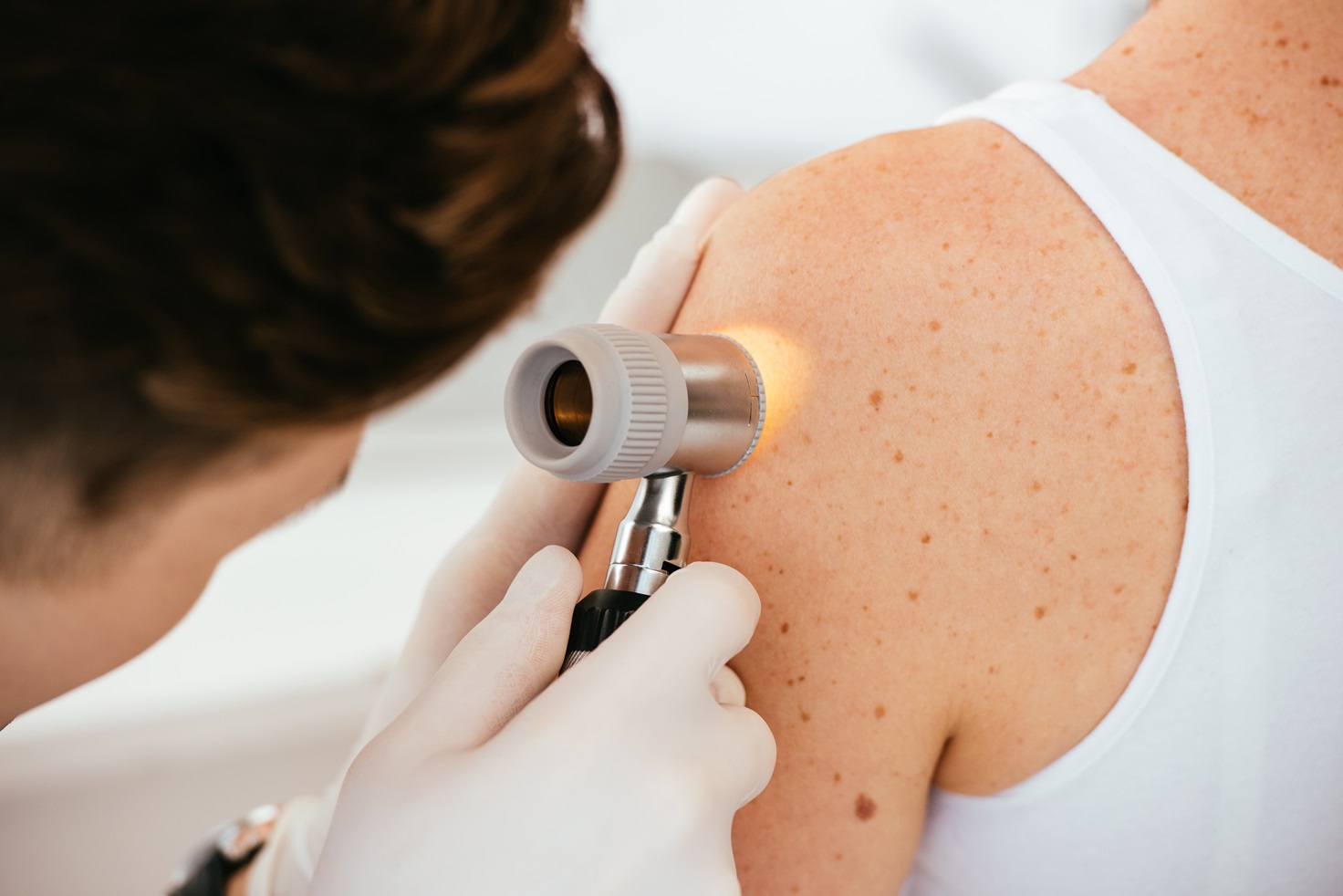 Patient Tracking for Skin Cancer Screening and Follow-Up Care