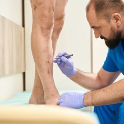 Simple Lifestyle Changes to Prevent and Manage Vein Disorders