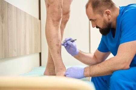 Simple Lifestyle Changes to Prevent and Manage Vein Disorders