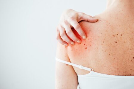 How to Track Your Skin Symptoms for Better Doctor Visits