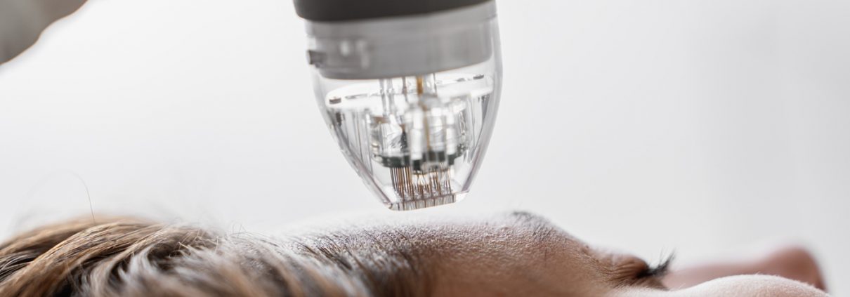 How to Protect Your Eyes from Laser Treatments
