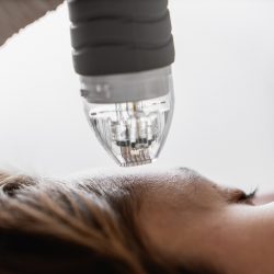 How to Protect Your Eyes from Laser Treatments and Procedures