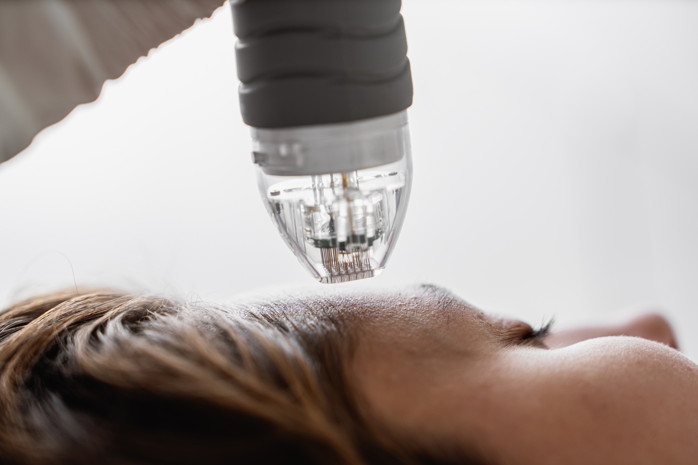 How to Protect Your Eyes from Laser Treatments