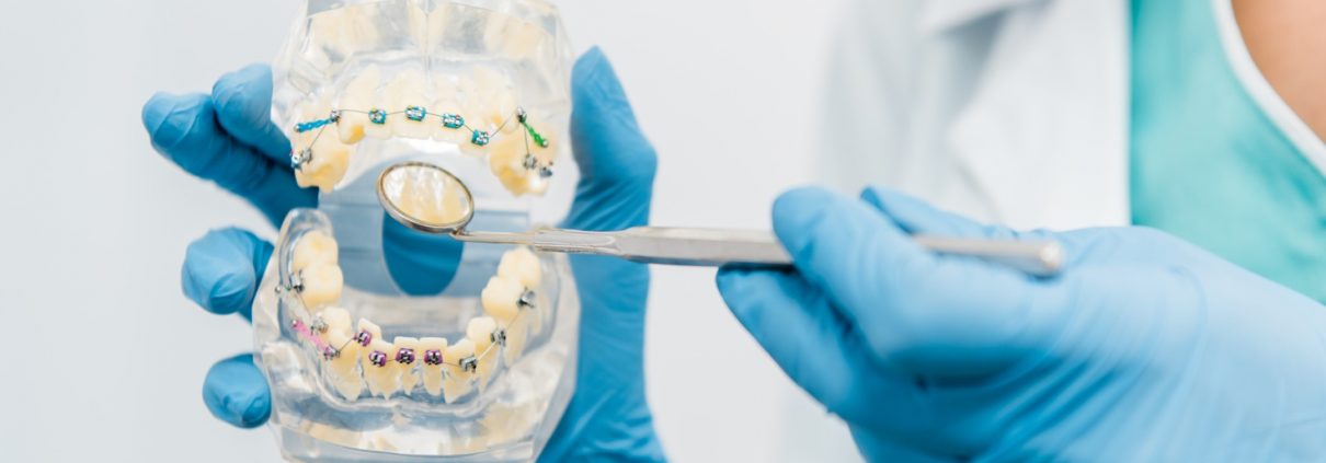 Exploring orthodontic treatment options