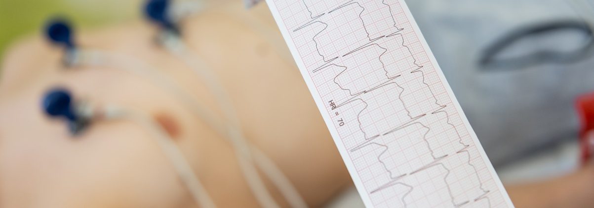 Understanding Abnormal EKG Findings Without Jumping to Conclusions