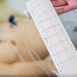 Understanding Abnormal EKG Findings Without Jumping to Conclusions