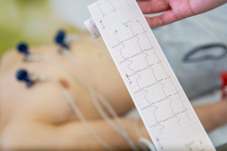 Understanding Abnormal EKG Findings Without Jumping to Conclusions