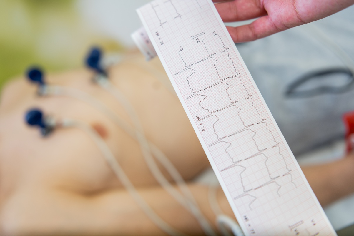 Understanding Abnormal EKG Findings Without Jumping to Conclusions