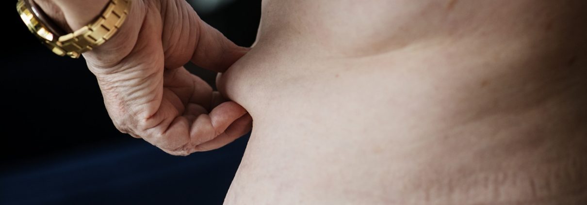 Patient Safety Tips for Abdominoplasty Procedures in Toronto