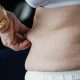 Patient Safety Tips for Abdominoplasty Procedures in Toronto